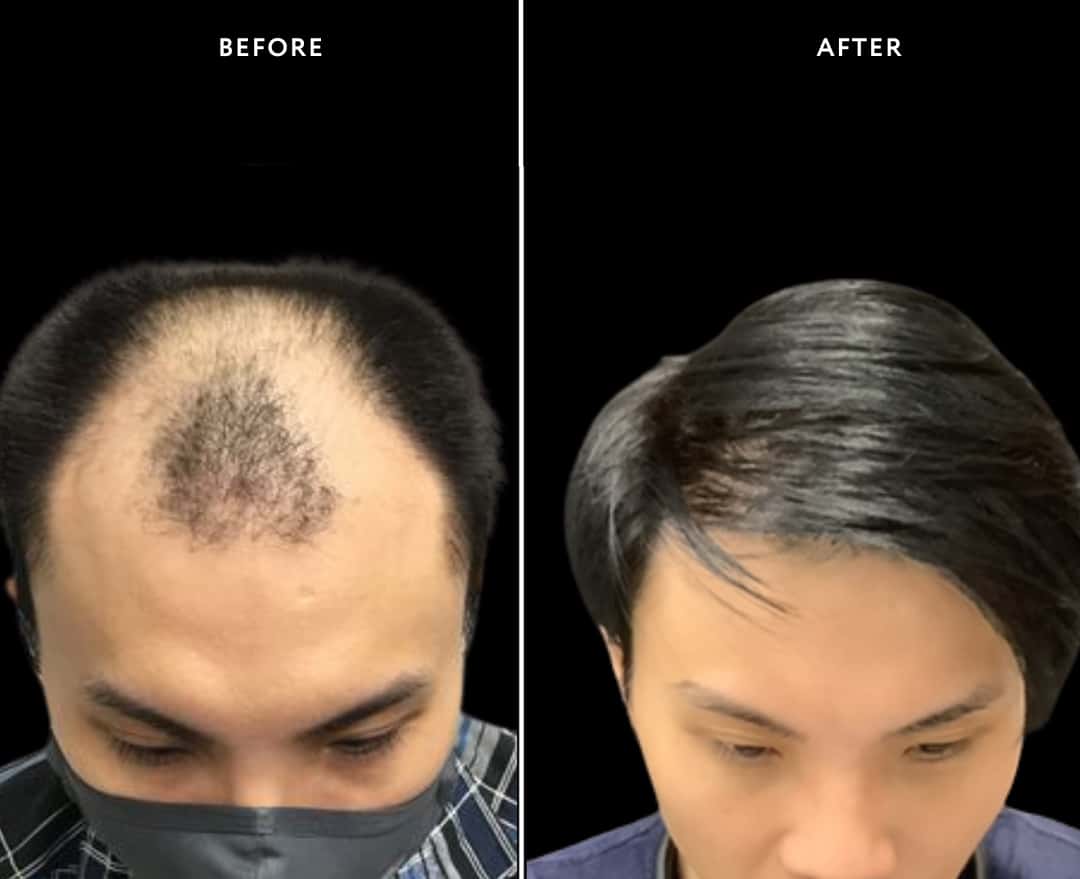 Hair 1